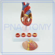 PNT-0401 Modèle anatomique cardiaque de matériel médical